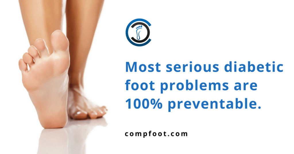 a kezelés stop foot diabetes)