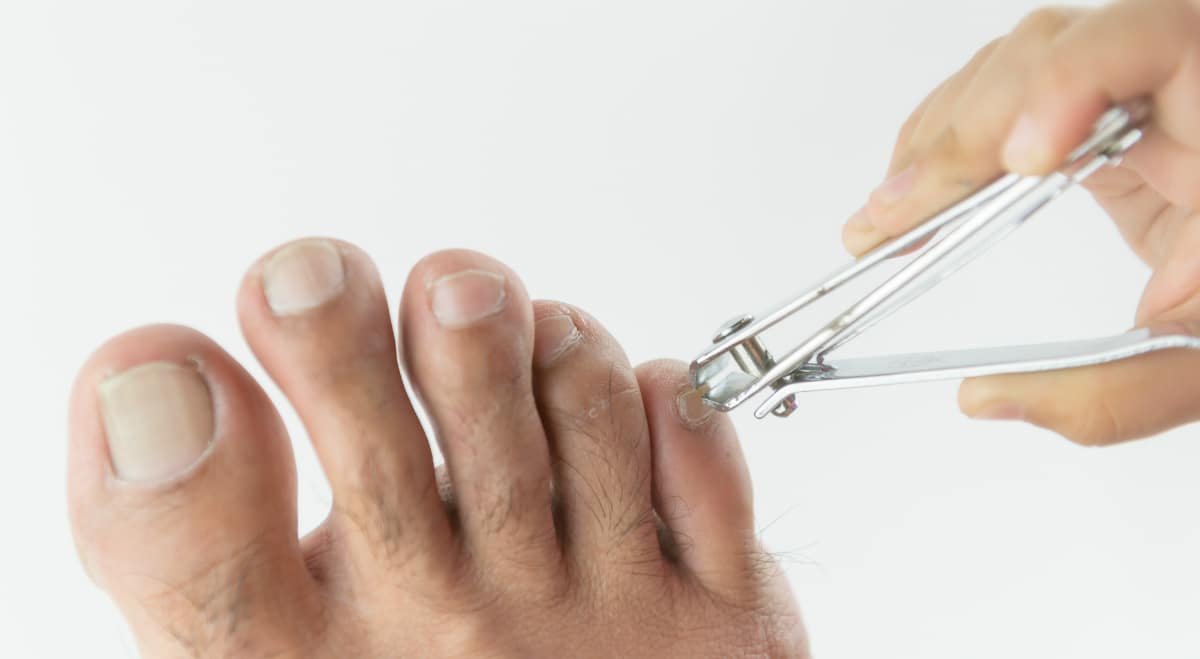 Man trimming toenails with nail clippers