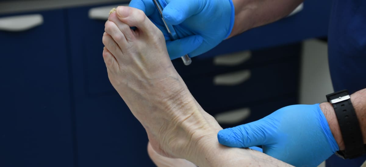 Podiatrist checking foot bunion