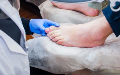 Ingrown Toenails: When to See Our Doctors