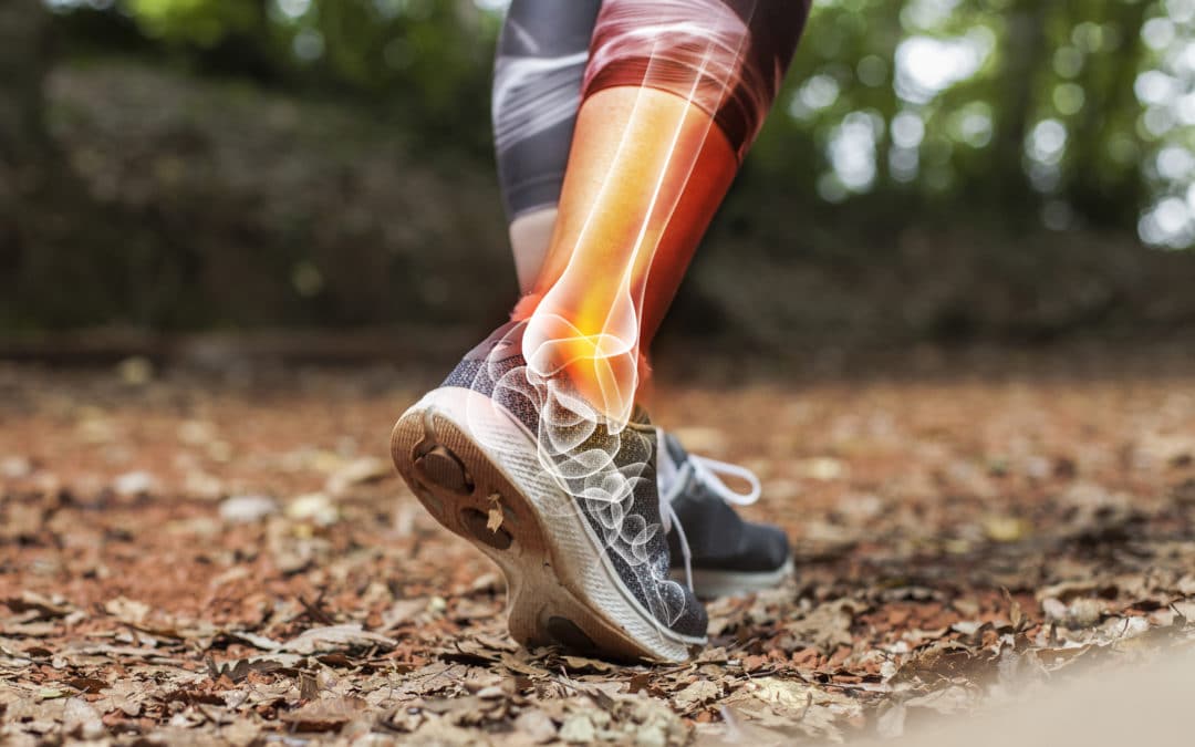 Finding the Ankle Treatment You Need in Kansas City