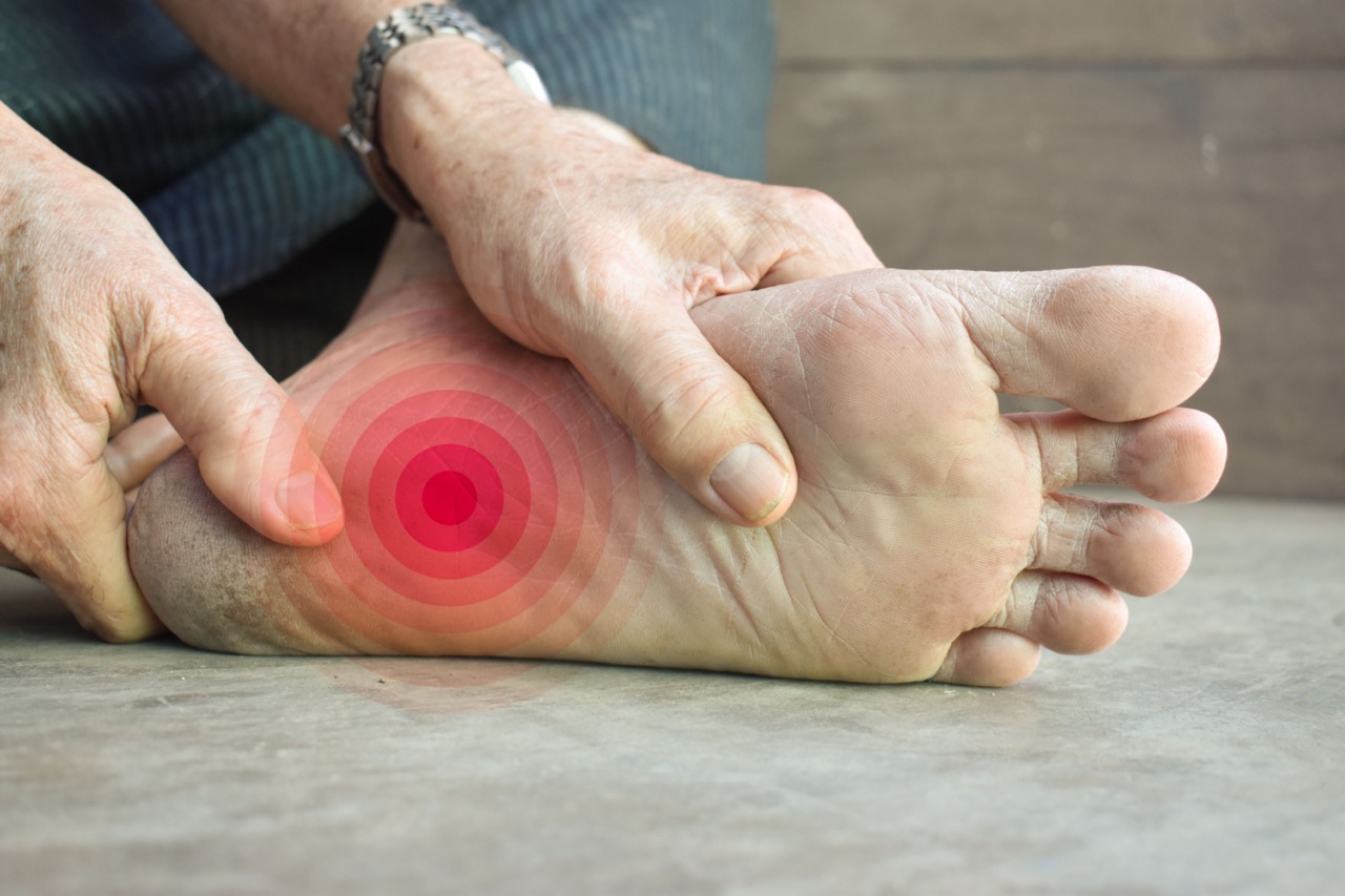 Neuropathy in foot