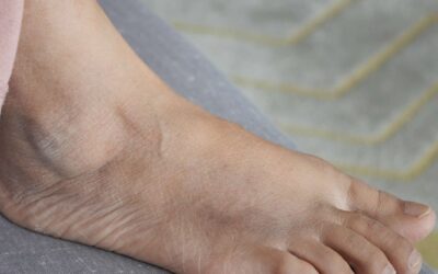 Diabetic Foot Care Guide