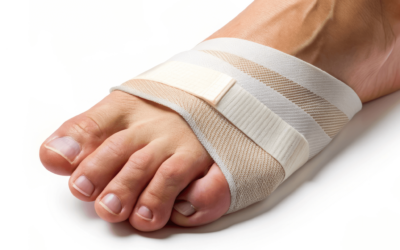 Foot Deformities: How to Fix Hammertoe